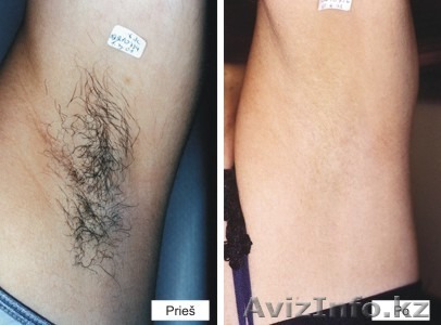 Салоны красоты, косметология, - Изображение #1, Объявление #1077587