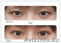 Стажировка для косметологов и врачей в Южной Корее  - Изображение #3, Объявление #808755