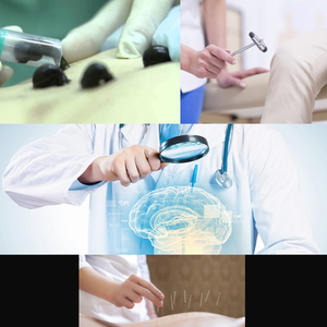 Иглотерапия,  пиявки,  невпапотолог НЕЙРО-МЕД