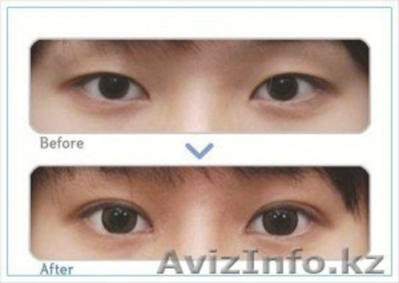 Стажировка для косметологов и врачей в Южной Корее  - Изображение #3, Объявление #808755