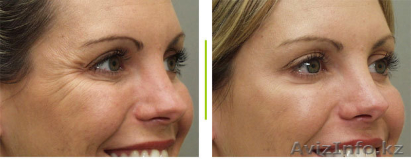 японские коллагеновые маски с био-золотом 24 карата от YokosoShiyuki   - Изображение #5, Объявление #941745